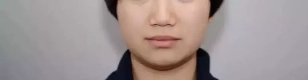 深覆盖vs深覆合,深覆盖和深覆合哪个难度大