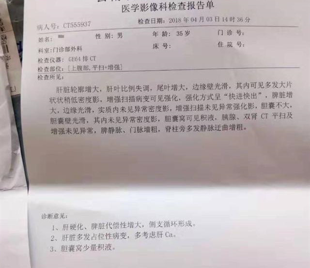 癌晚期生存期,肝癌晚期癌栓怎么治