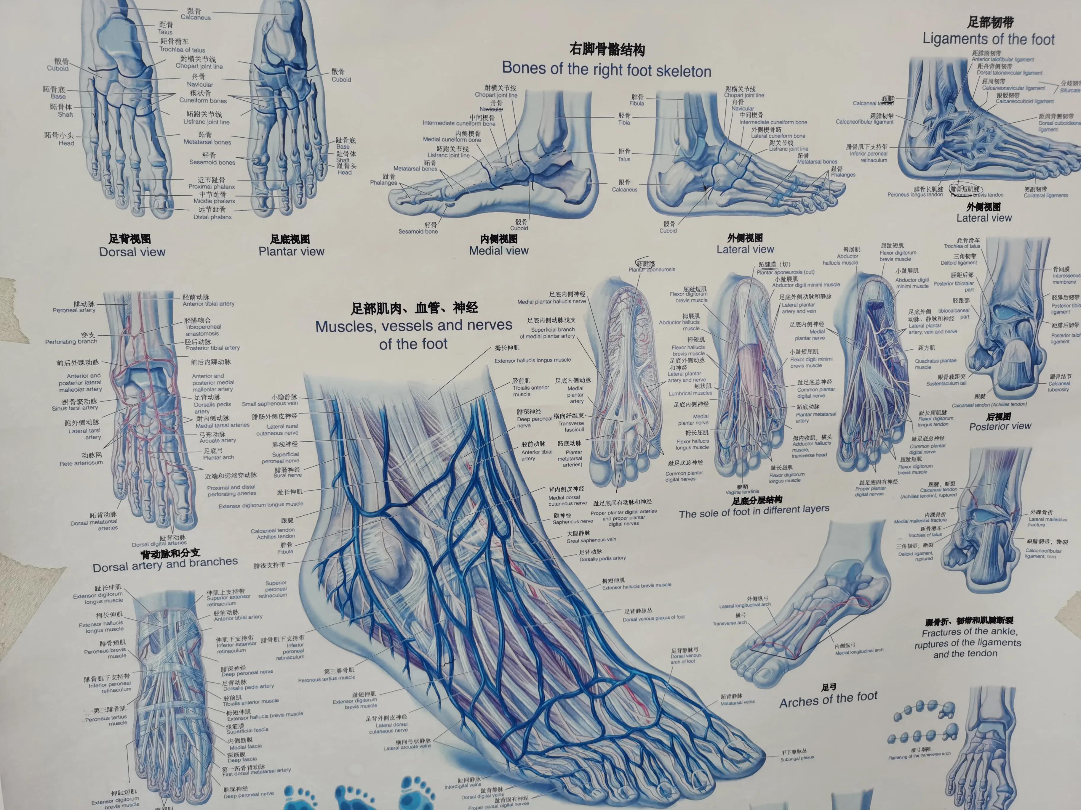 第五跖骨粉碎性骨折多久后能走路,第五跖骨基底骨折100天了走路肿
