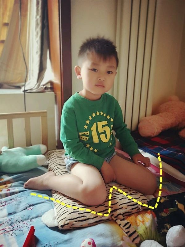 小孩喜欢勾腿是为什么,幼儿罗圈腿会自己好吗
