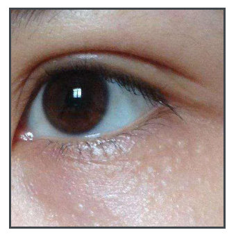 拯救黑眼圈泪沟的偏方,纯干货史上最全的对付黑眼圈攻略