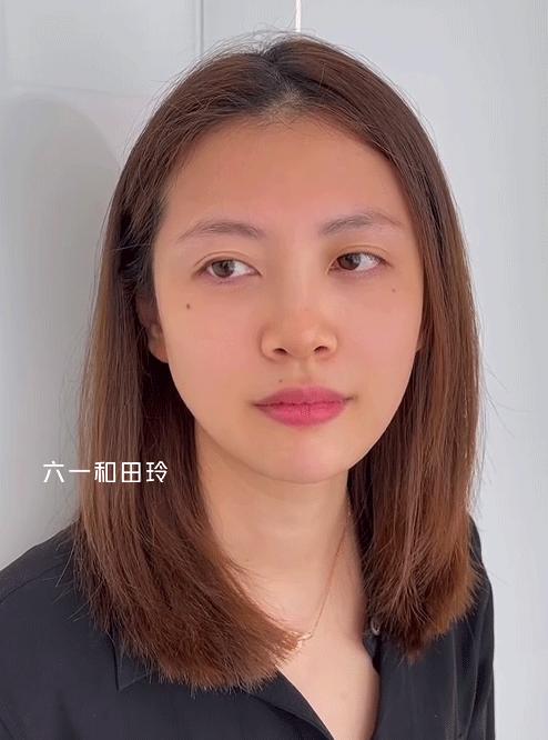 带娃长期熬夜的眼袋怎么去除,女人35岁以后一熬夜眼袋深怎么办