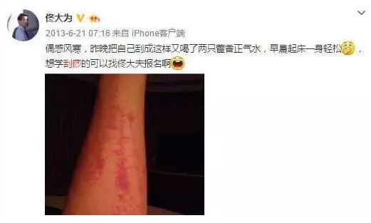 孙俪、佟大为等明星纷纷养生,但关于“养生”的英文你知道多少?