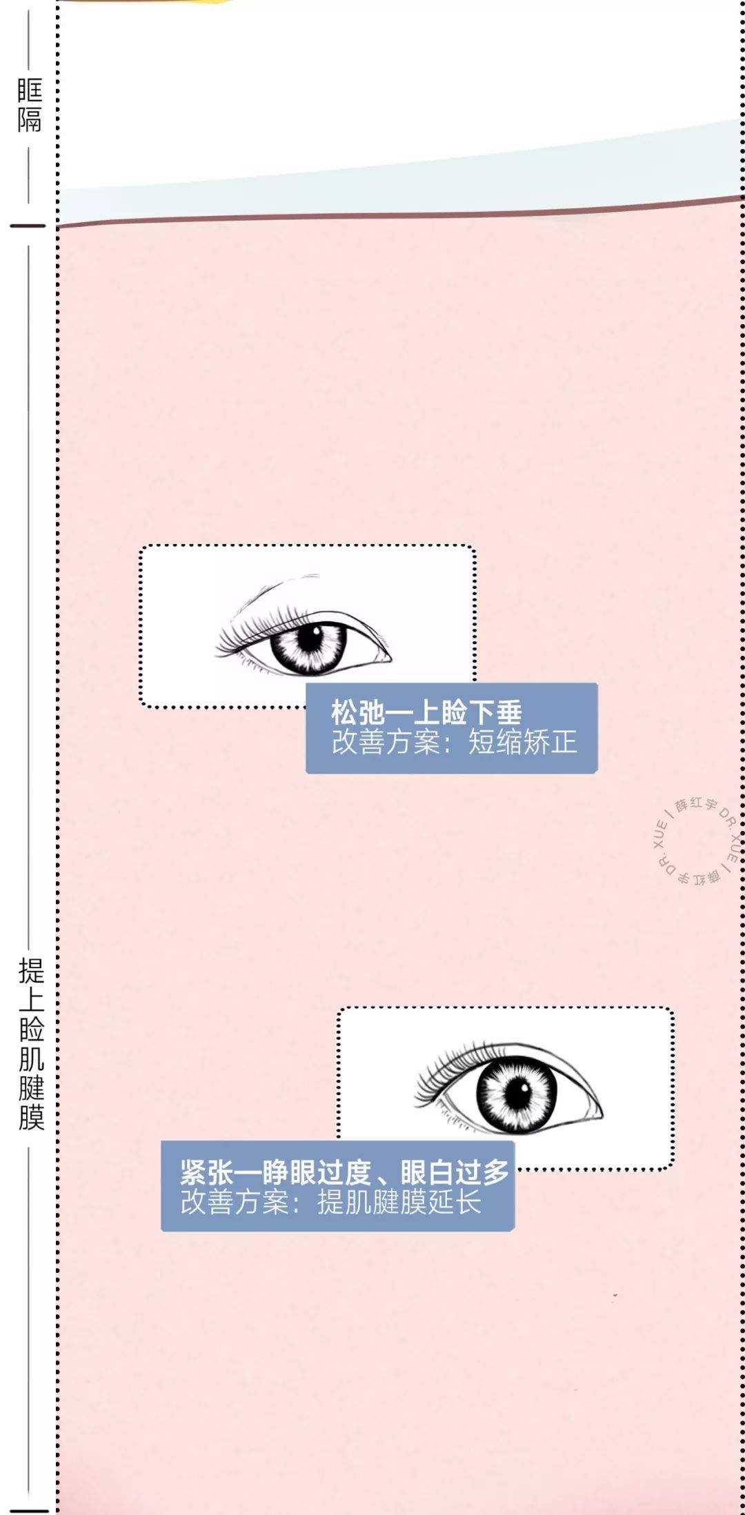 眼睛种类图解漫画,漫画眼睛的几种形态