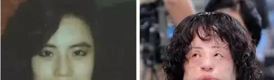 年轻的时候整容老了脸会崩吗,整过形的脸老了好不好