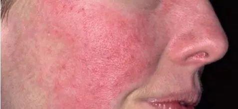 效果很快的护肤品安全吗,效果特别好的护肤品有激素吗