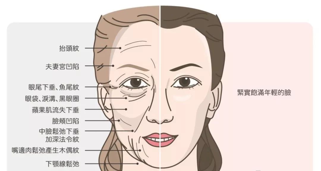 脸上有法令纹去除最好的方法,一般情况最早多大年龄出现法令纹