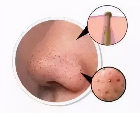 宋威龙对赵露思的评价,宋威龙痘痘肌