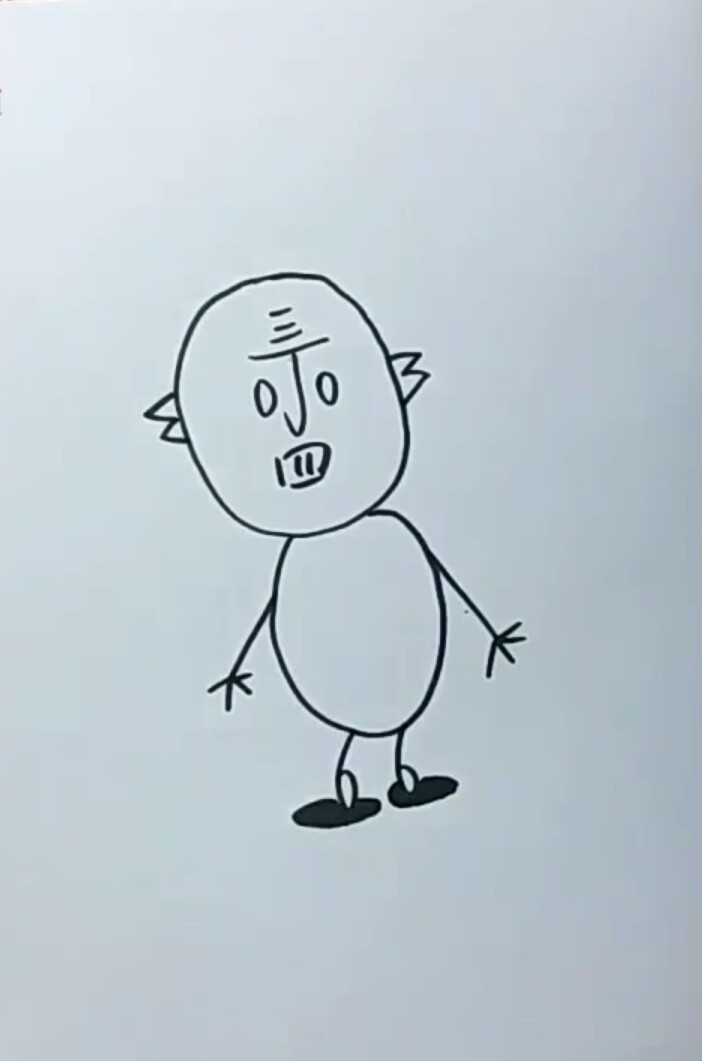 抬头纹严重如何改善,该怎么矫正抬头纹