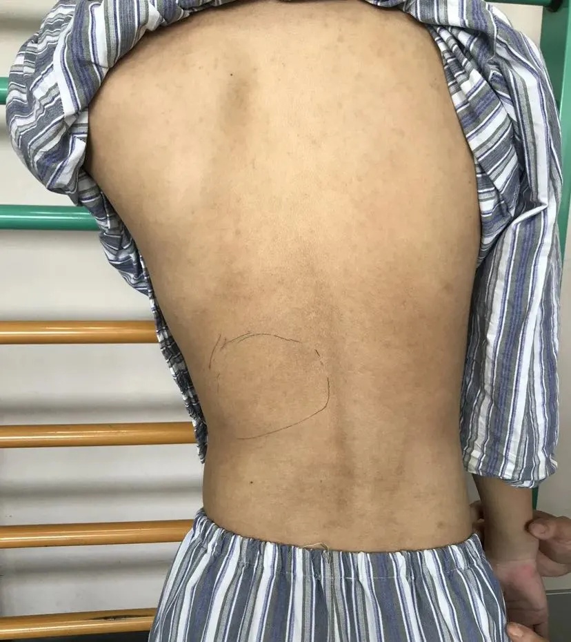 科创助力,康复护理科创新项目