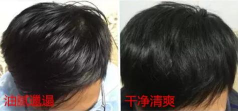 澳洲茶树精油洗发水去头屑,头发一摸全是油