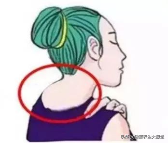 铲平富贵包,平整富贵包