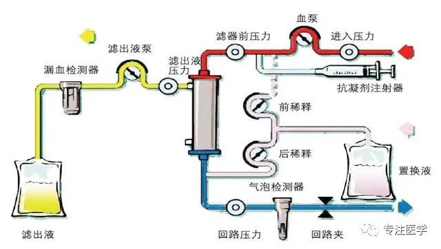 CRRT治疗的指征及时机