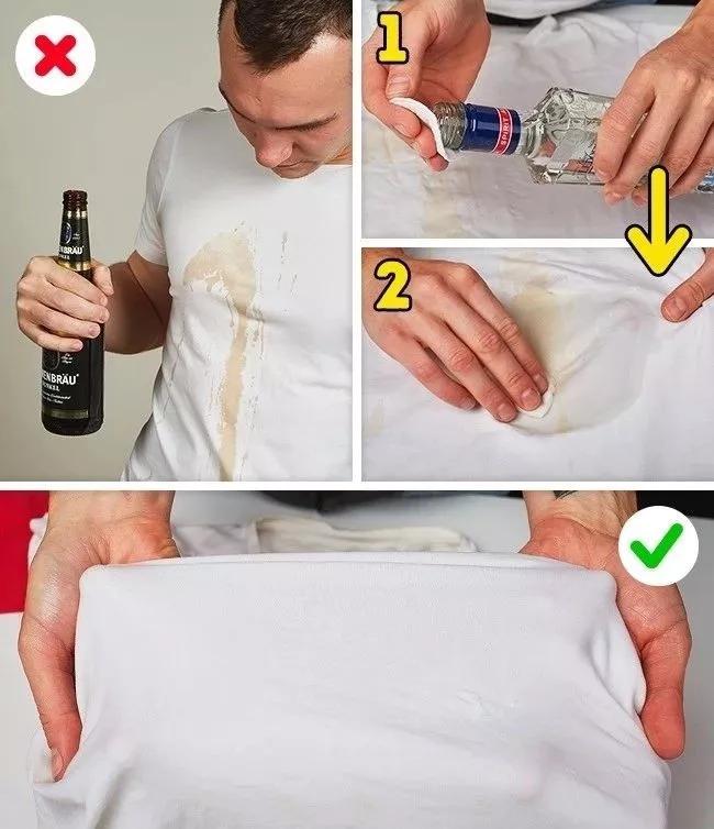 名门泽佳去眼袋红肿结痂图片,名门泽佳去眼袋效果怎么样