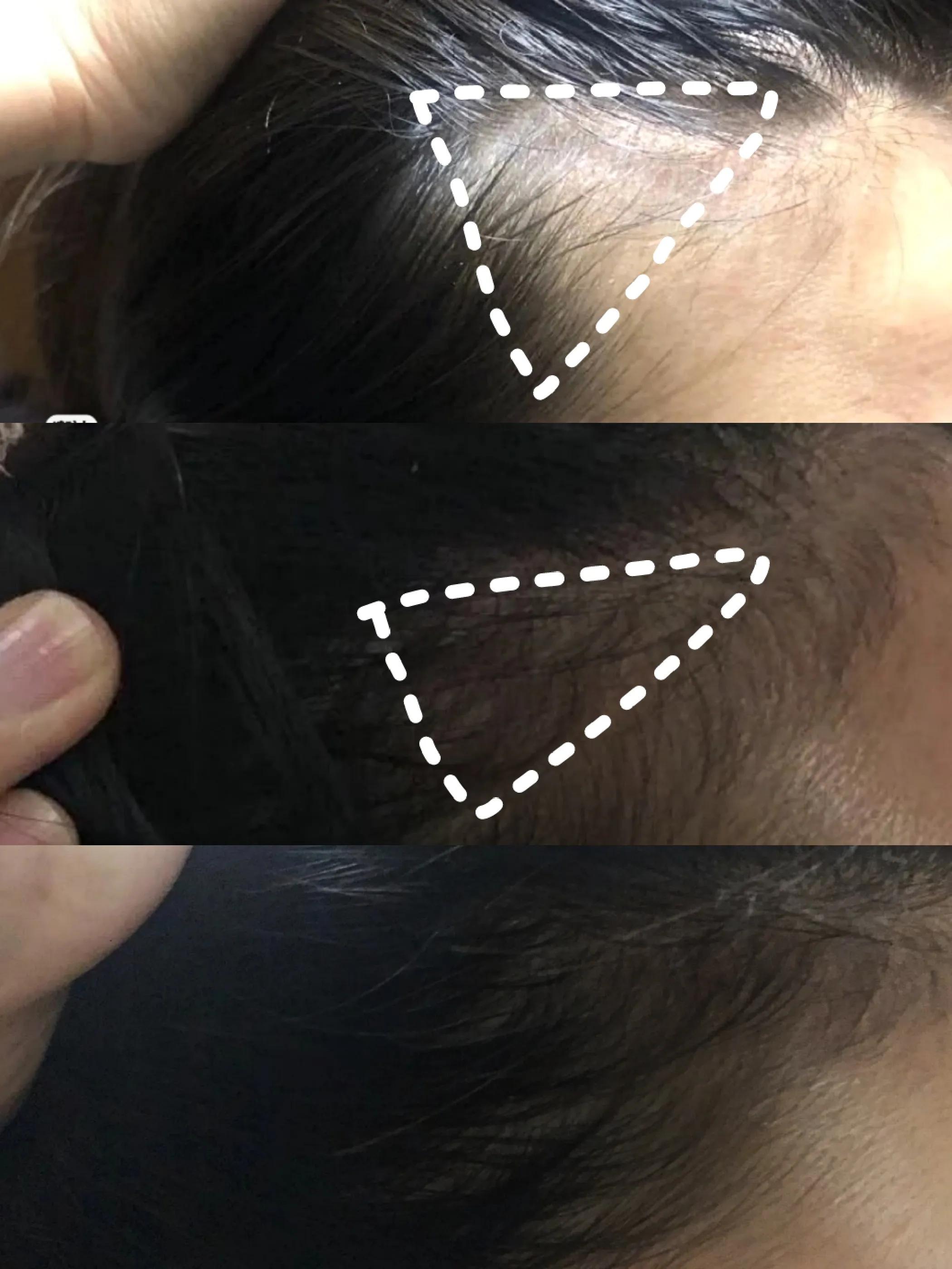 碎发留长发的过渡期鬓角怎么弄,鬓角碎发怎么p掉