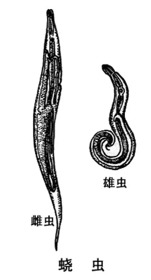 重口味科普，挠完“菊花”要不要洗手？