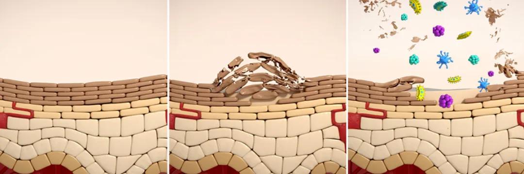 皮肤屏障受损怎么修复最简单有效,可预修复皮肤屏障受损的医用产品