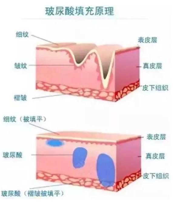 科普|光子嫩肤全攻略,做了光子后禁忌事项有哪些?
