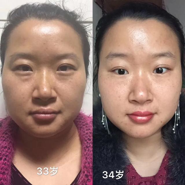 补充胶原蛋白是智商税吗,吃肉皮能补充胶原蛋白吗