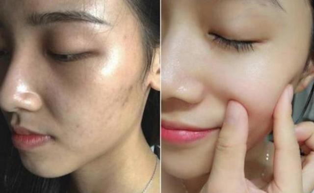 百雀羚精华液有几款,继百雀羚后国内又一精华液走红