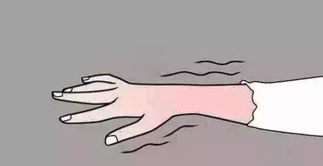 冻疮是由于血脉不通引起的吗,冻疮是因为太冷了吗