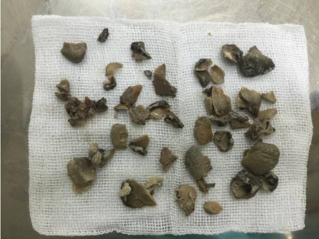 牙龈出血牙齿疏松怎么治疗,牙龈出血发黑是怎么解决