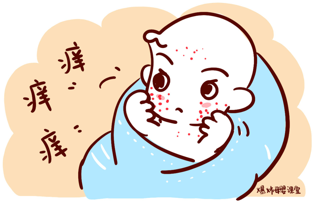 孩子得水痘需要注意什么事项,小孩得了水痘要怎么护理