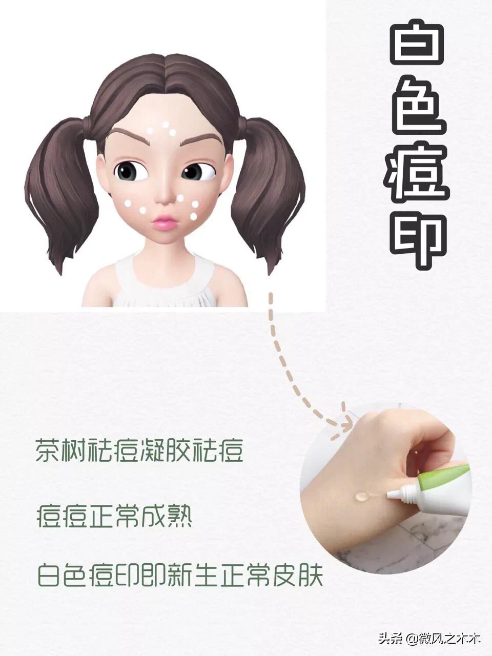 痘印痘坑消除要做多少次医美,去痘印痘坑痘疤的医美方法