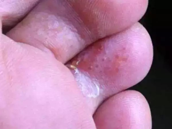 走在“云端上”的拖鞋，震撼脚丫的棉花级触感，一秒解压超柔软