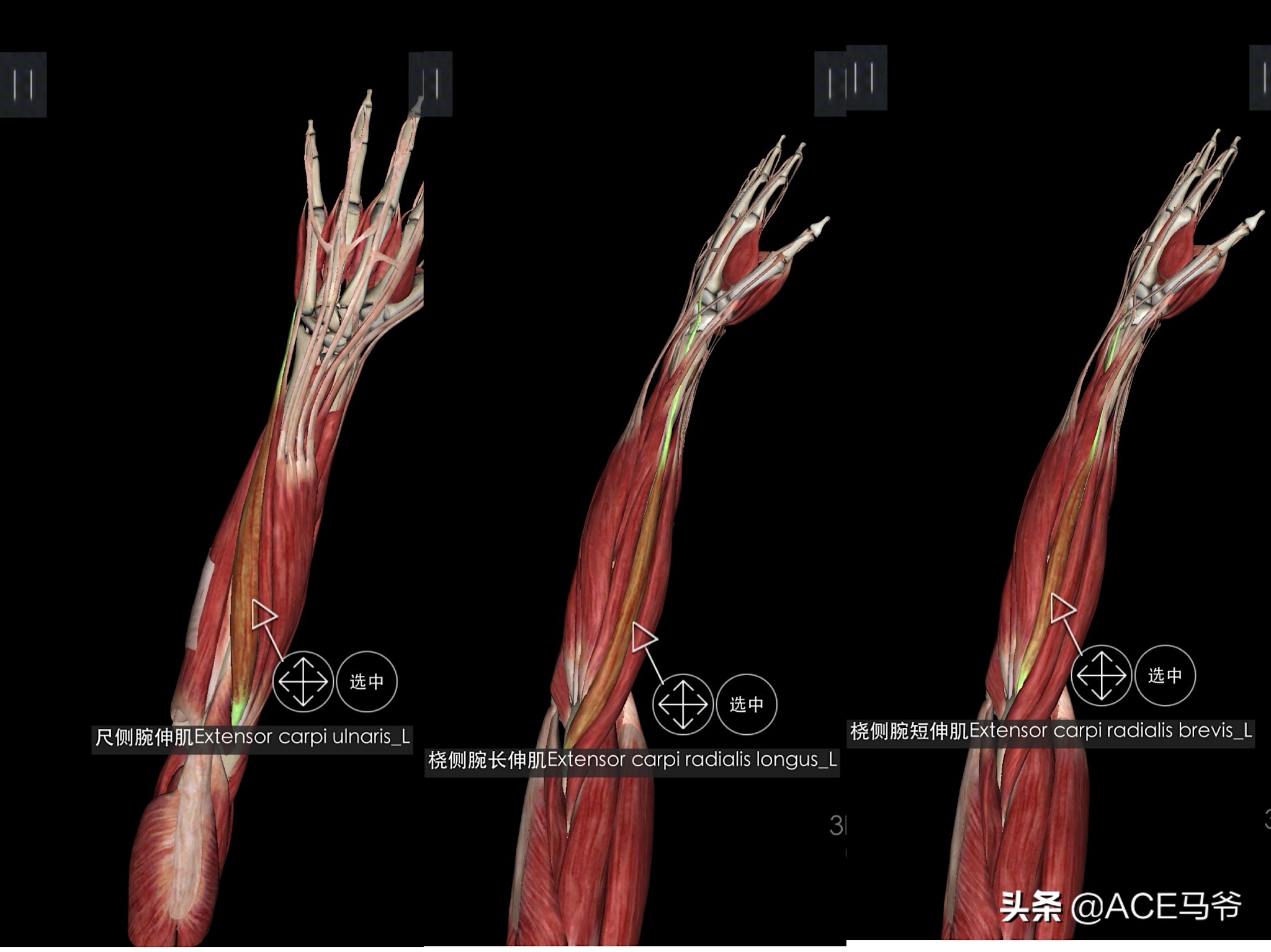 最容易被忽视，但是又非常重要的训练。小臂力量训练