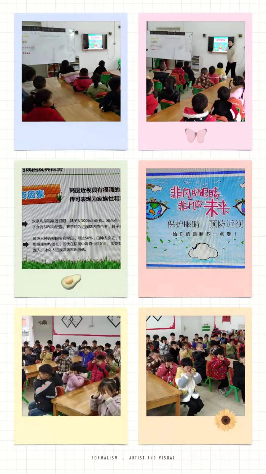 幼儿园爱护眼睛宣传资料,幼儿园爱护眼睛信息报道