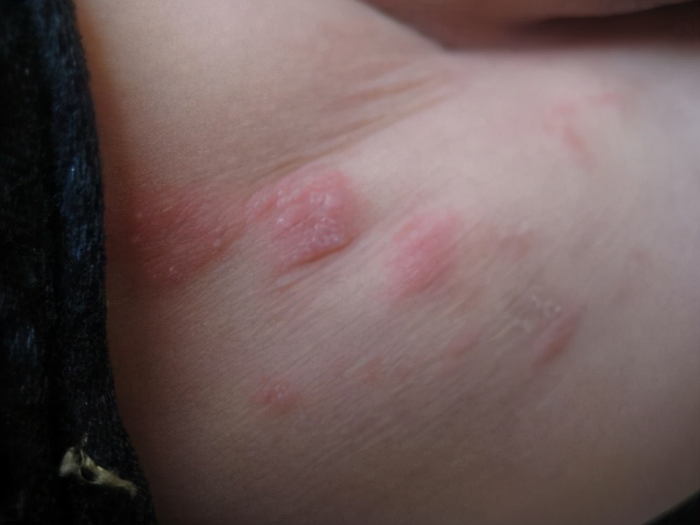 宝宝用湿巾擦屁股的正确方法,为什么用湿巾给宝宝擦屁股会红