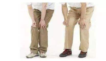 滑膜炎来袭，还有什么可以阻挡？