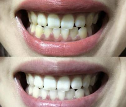 高伟光同款牙刷,高伟光牙刷介绍