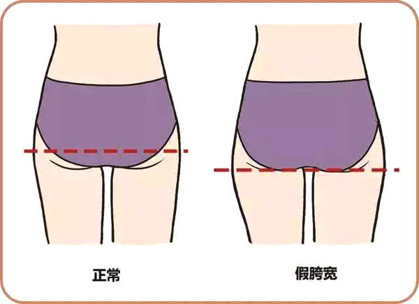 如何练习开髋和收胯,胯大能练习开髋吗