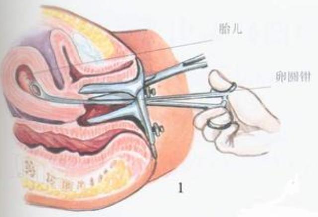 流过产的女性会有什么表现,流过产的女人好吗