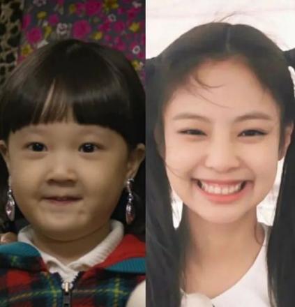 年纪不大为什么会有明显的法令纹,年纪轻轻为什么有很严重的法令纹