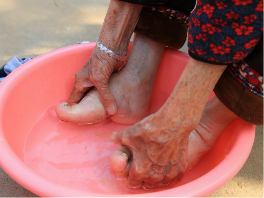 6岁为“美”被迫缠脚：三寸小脚走到百岁，看这位奶奶活成啥样子