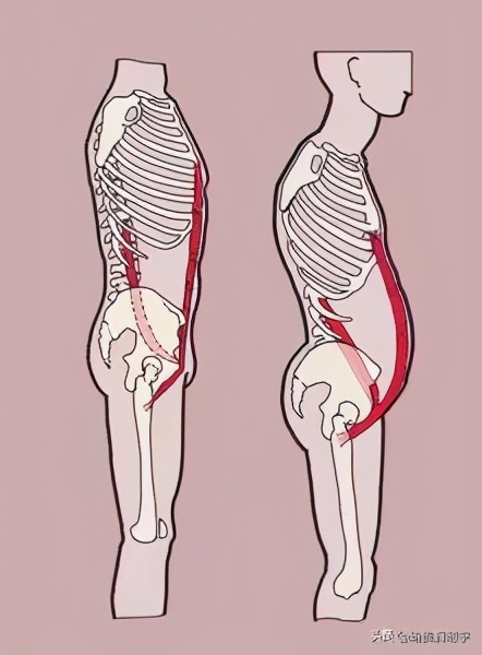 腰痛的原因及预防方法,腰痛的10个征兆图