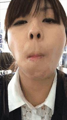 为什么会下颌突出,为什么下颌角突出