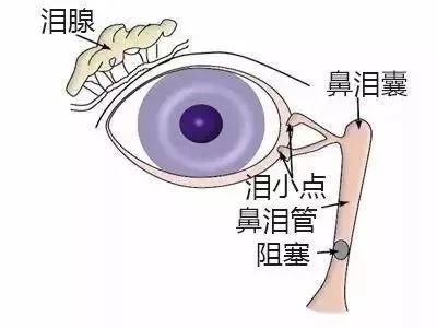 新生宝宝眼屎多什么原因,新生宝宝眼屎黄脓状怎么办