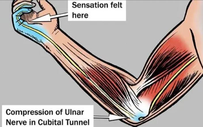 趴在床上玩手机胳膊麻,躺床上玩手机导致手麻头晕