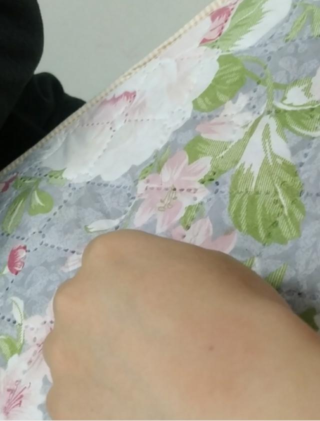 腱鞘囊肿中医神奇治疗方法,腱鞘囊肿针灸治疗