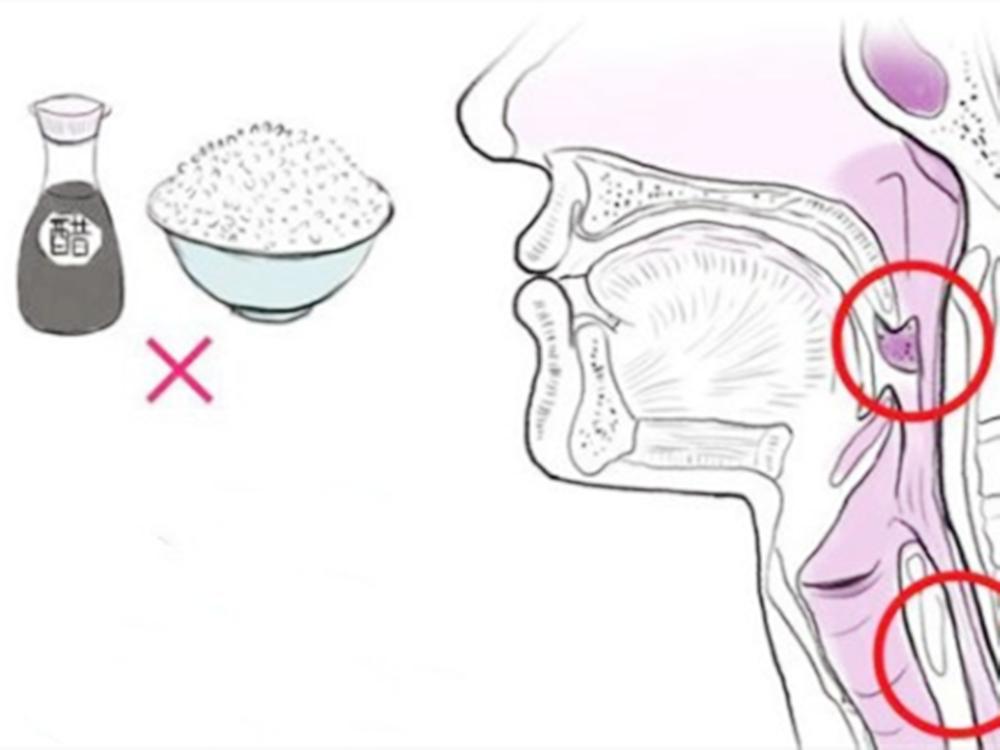 小孩吃鱼被鱼刺卡到怎么办,宝宝被鱼刺卡喉咙一招搞定