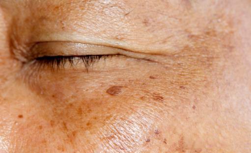 拒绝斑点不做斑点女孩,拒绝纹身女生