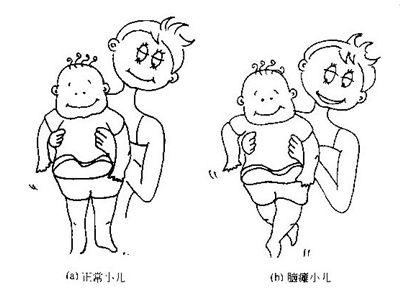 脑瘫儿童智商发育慢怎么办,脑瘫儿童智商低怎么办