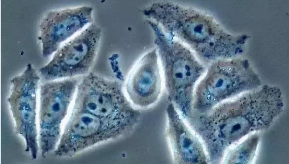 “永生”的拉克斯：身患绝症却成研究对象，被科学界无偿利用70年