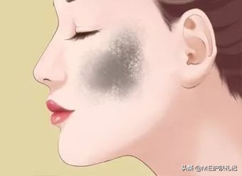 薇绮美胶原蛋白淡化色斑,ME胶原蛋白肽怎么样