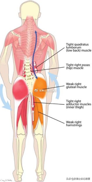 体态纠正骨盆旋转,体态矫正大小脸