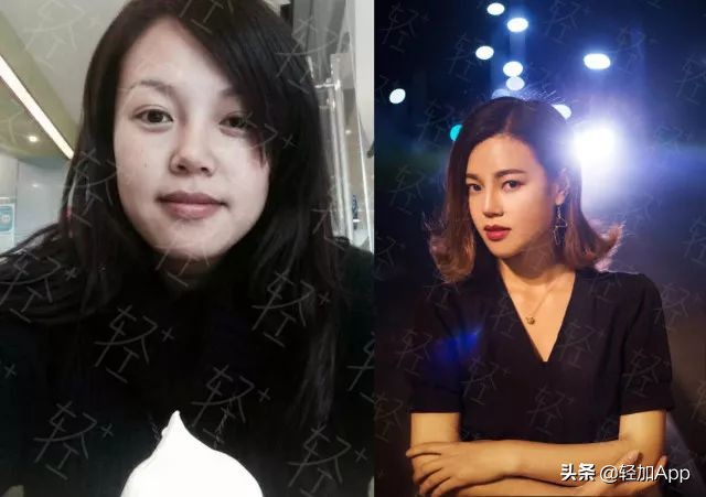 按摩减肥为啥能瘦下来,埋线减肥真的能瘦10斤吗